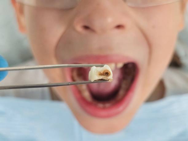 Best Emergency Dental Clinic in NE